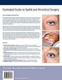 Illustrated Guide to Eyelid and Periorbital Surgery, 1