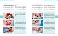 Bildatlas Lidchirurgie, 1