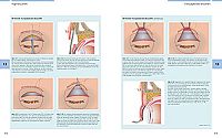 Bildatlas Lidchirurgie, 3