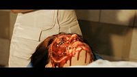 Plastic Surgery Massacre [DVD], 3