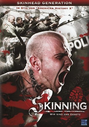 Skinning - Wir sind das Gesetz [DVD]