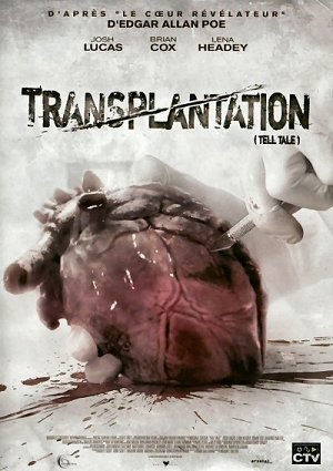 Transplantation [DVD]