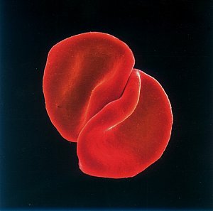 Scratch My Back [CD]