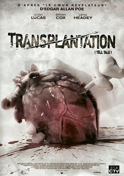 Transplantation [DVD]