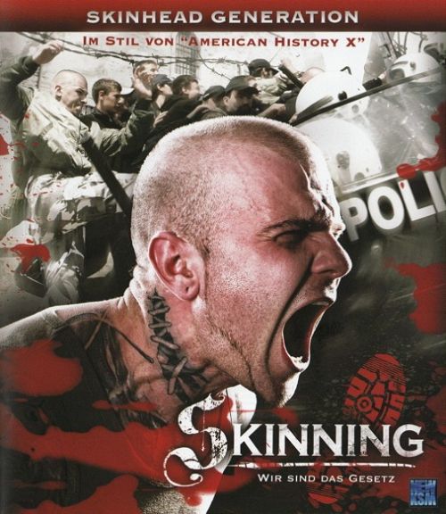 Skinning - Wir sind das Gesetz [Blu-ray]